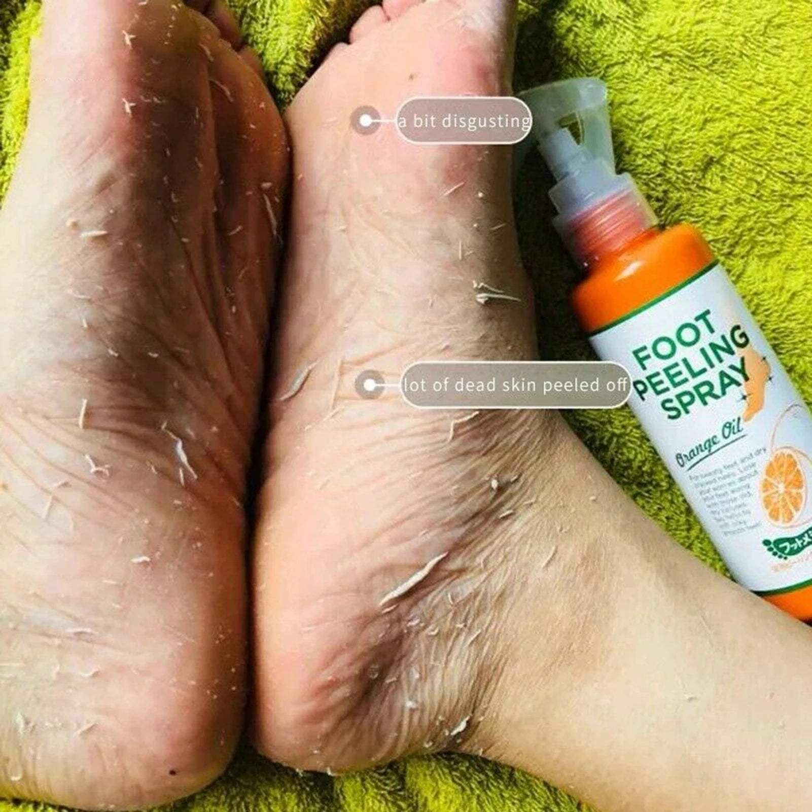 110ml Foot Peeling Spray – Exfoliating Dead Skin Remover, Moisturizing Pore Care for Feet, Elbows & Knees - Hardonia