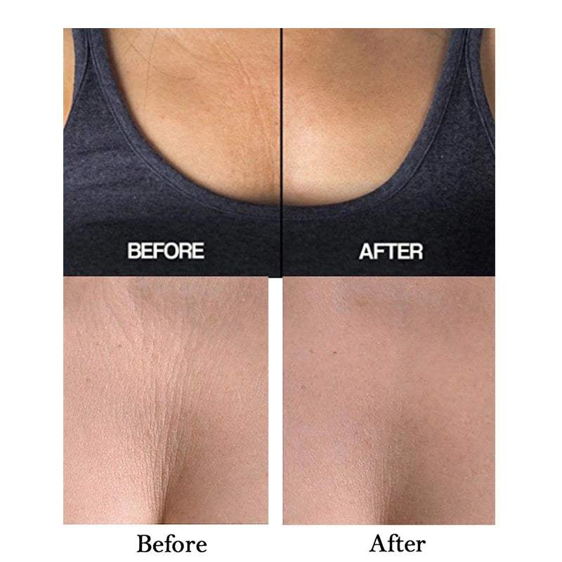 Silicone Chest Wrinkle Pads – Reusable Medical Grade Silicone Patches for Décolleté, Neck & Chest Line Reduction - Hardonia